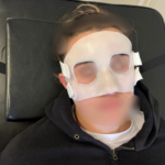 Masque de protection sur-mesure pour fracture du nez : accompagner une handballeuse vers un retour rapide à Châtellerault
